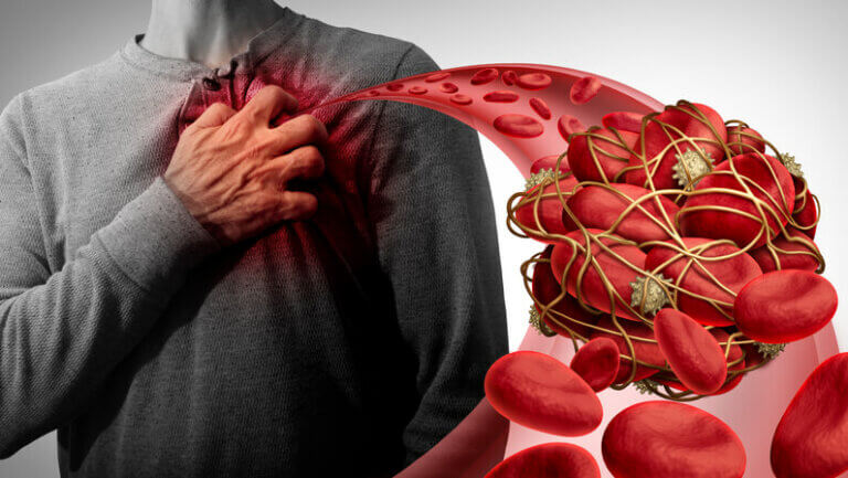A person experiencing blood clot