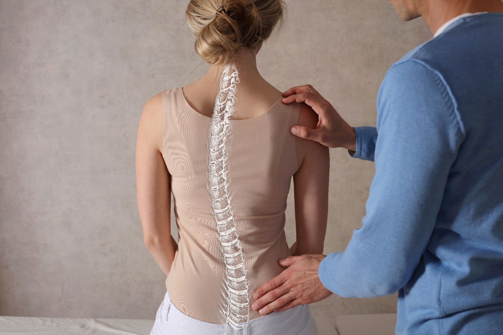 women diagnosed with scoliosis