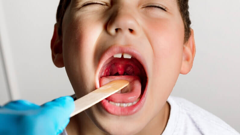 young boy with white pot on throat open his mouth widely