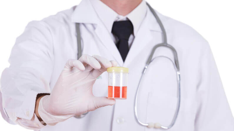 doctor holding a bottle of urine with blood