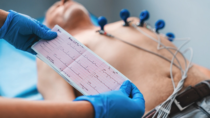 Electrocardiogram, ECG in hand. Cardiogram printout on male patient background