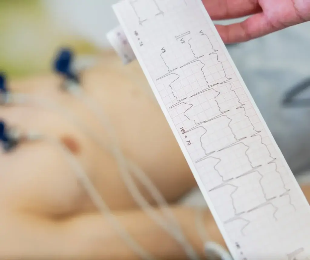 Cardiac Monitoring