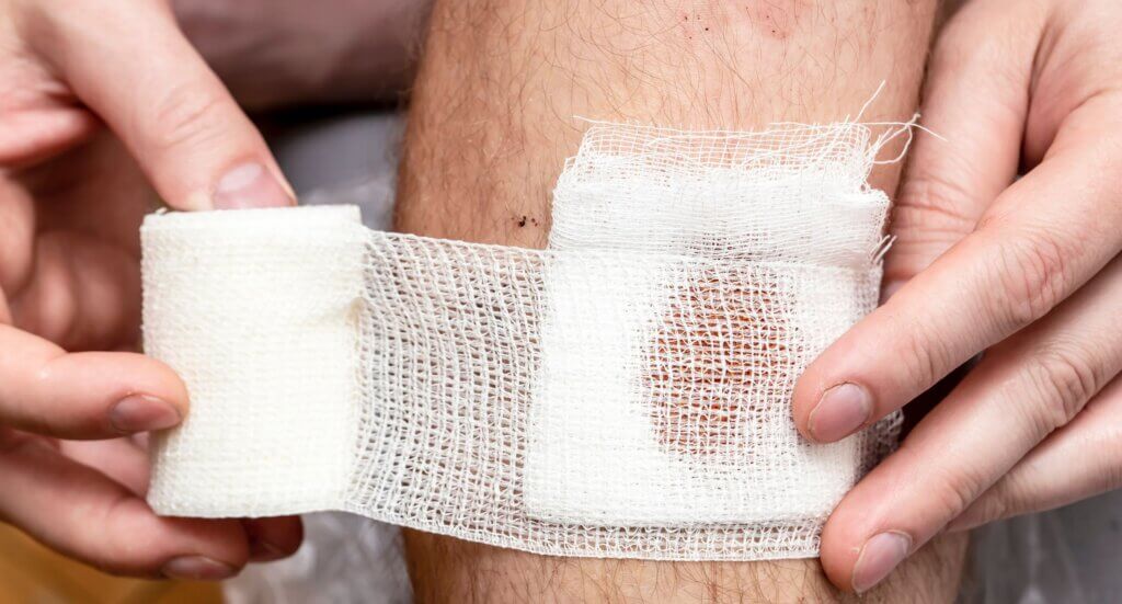 Stop the bleeding