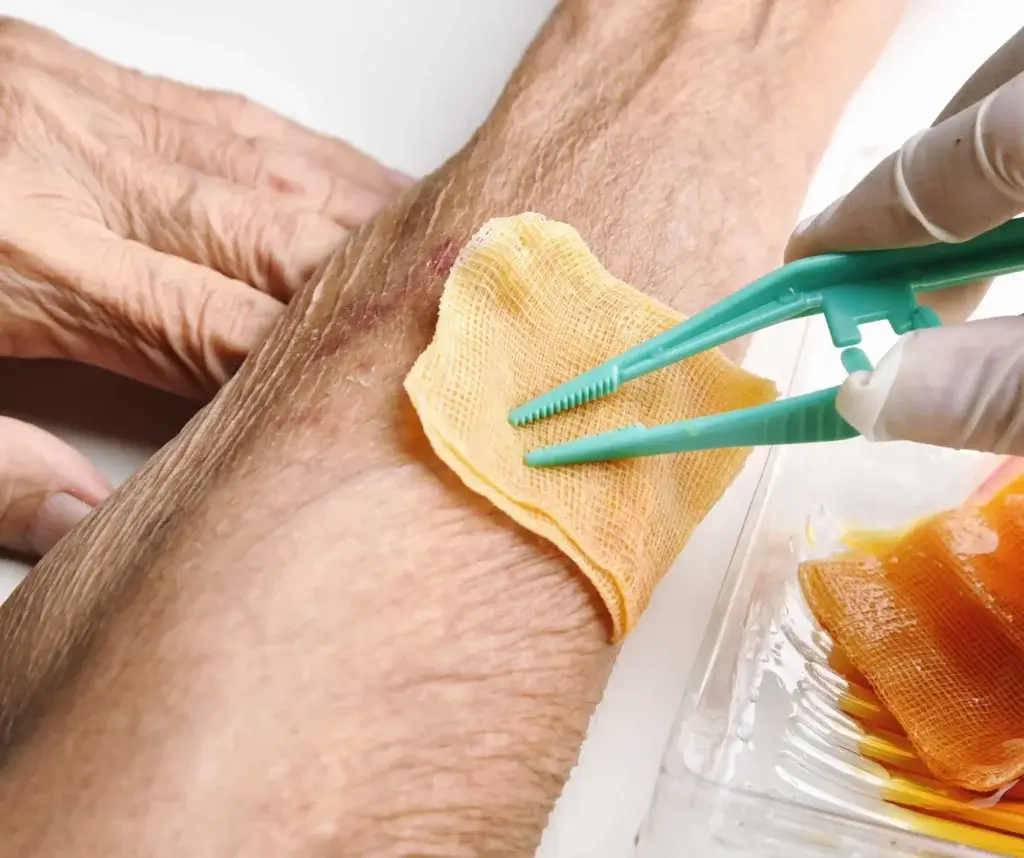 Wound Irrigation And Cleaning