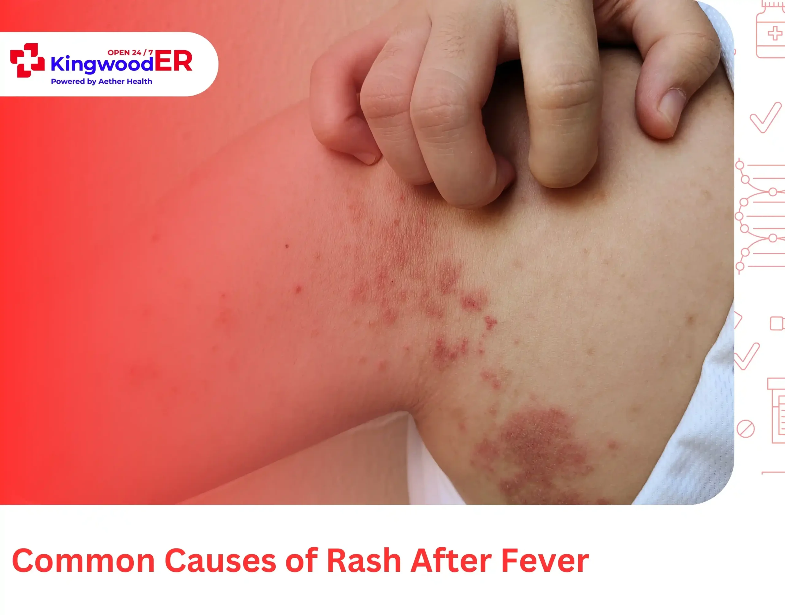 Common Causes of Rash After Fever