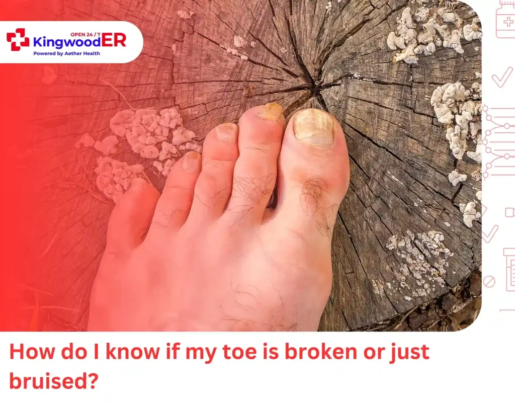 How do I know if my toe is broken or just bruised