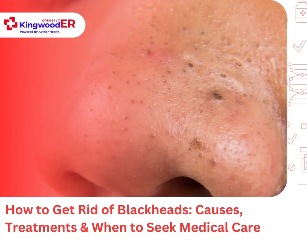 How to Get Rid of Blackheads Causes, Treatments & When to Seek Medical Care