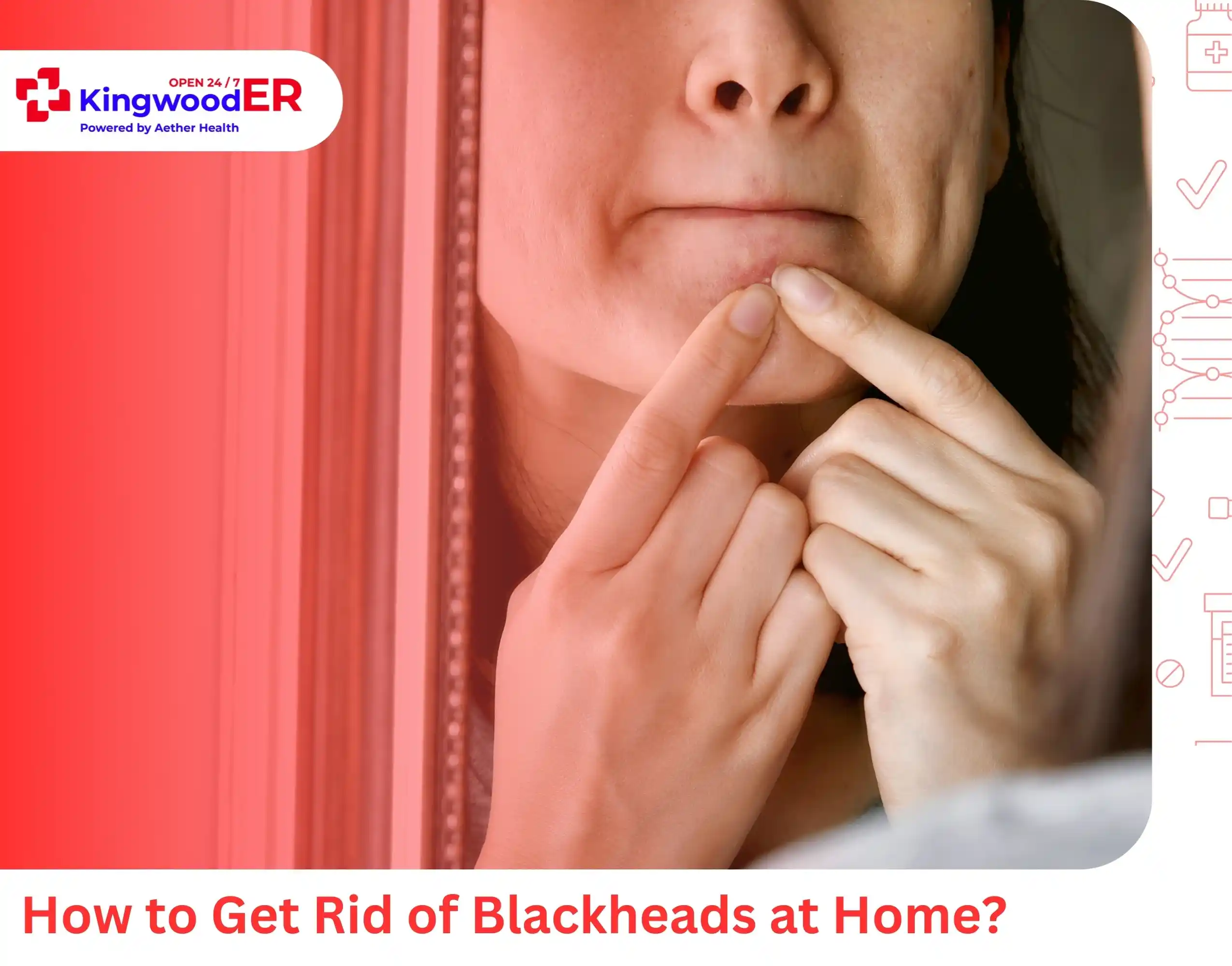 How to Get Rid of Blackheads at Home