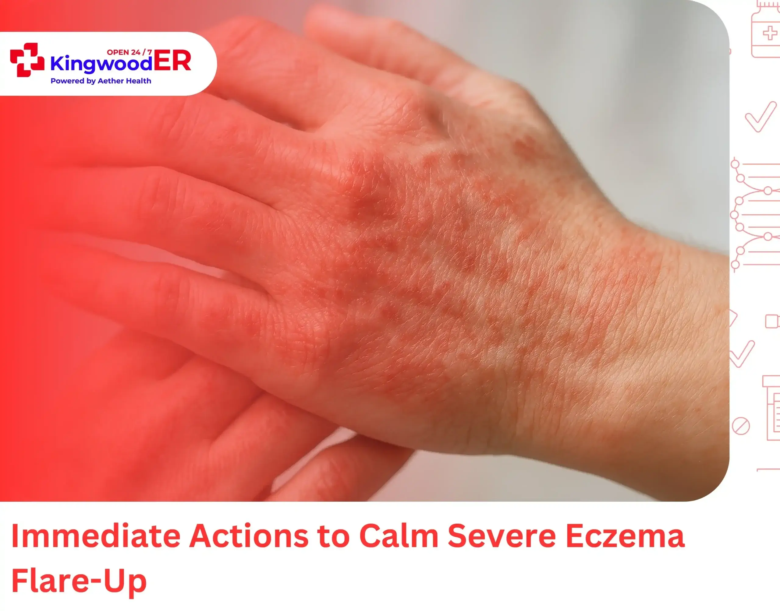 Immediate Actions to Calm Severe Eczema Flare-Up