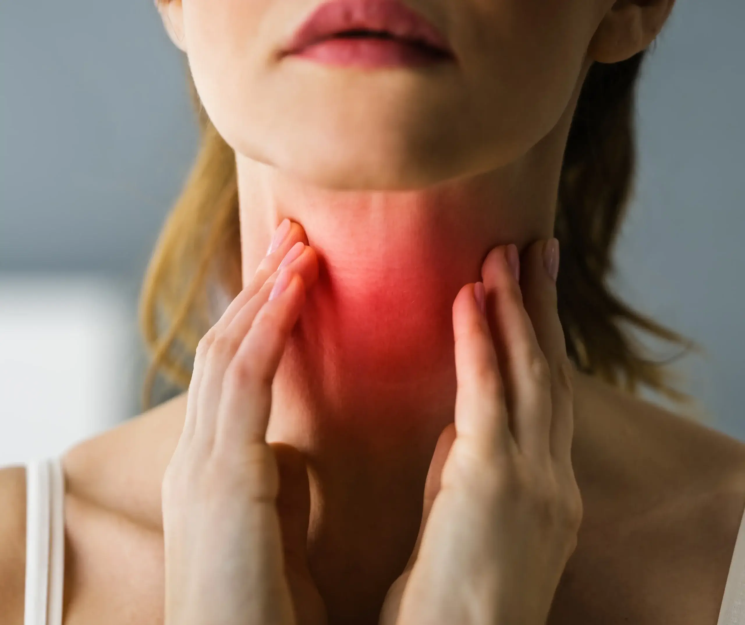Signs that suggest viral sore throat scaled