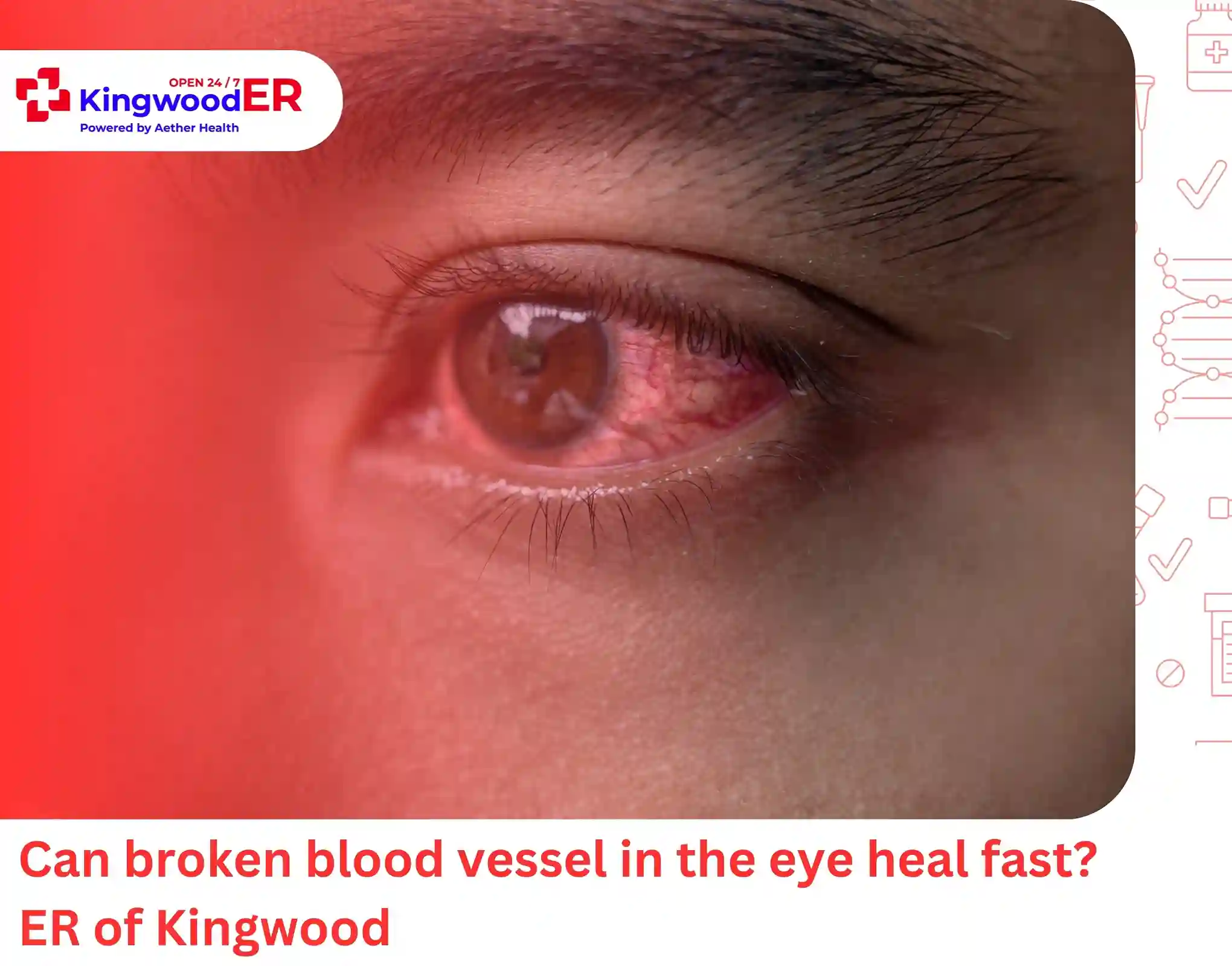 Can broken blood vessel in the eye heal fast