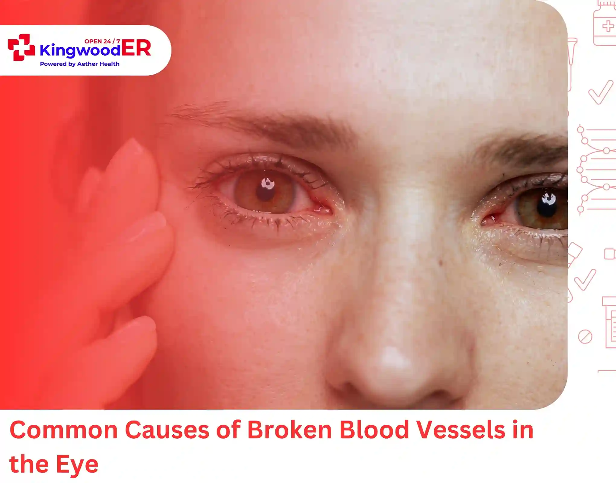 Common Causes of Broken Blood Vessels in the Eye