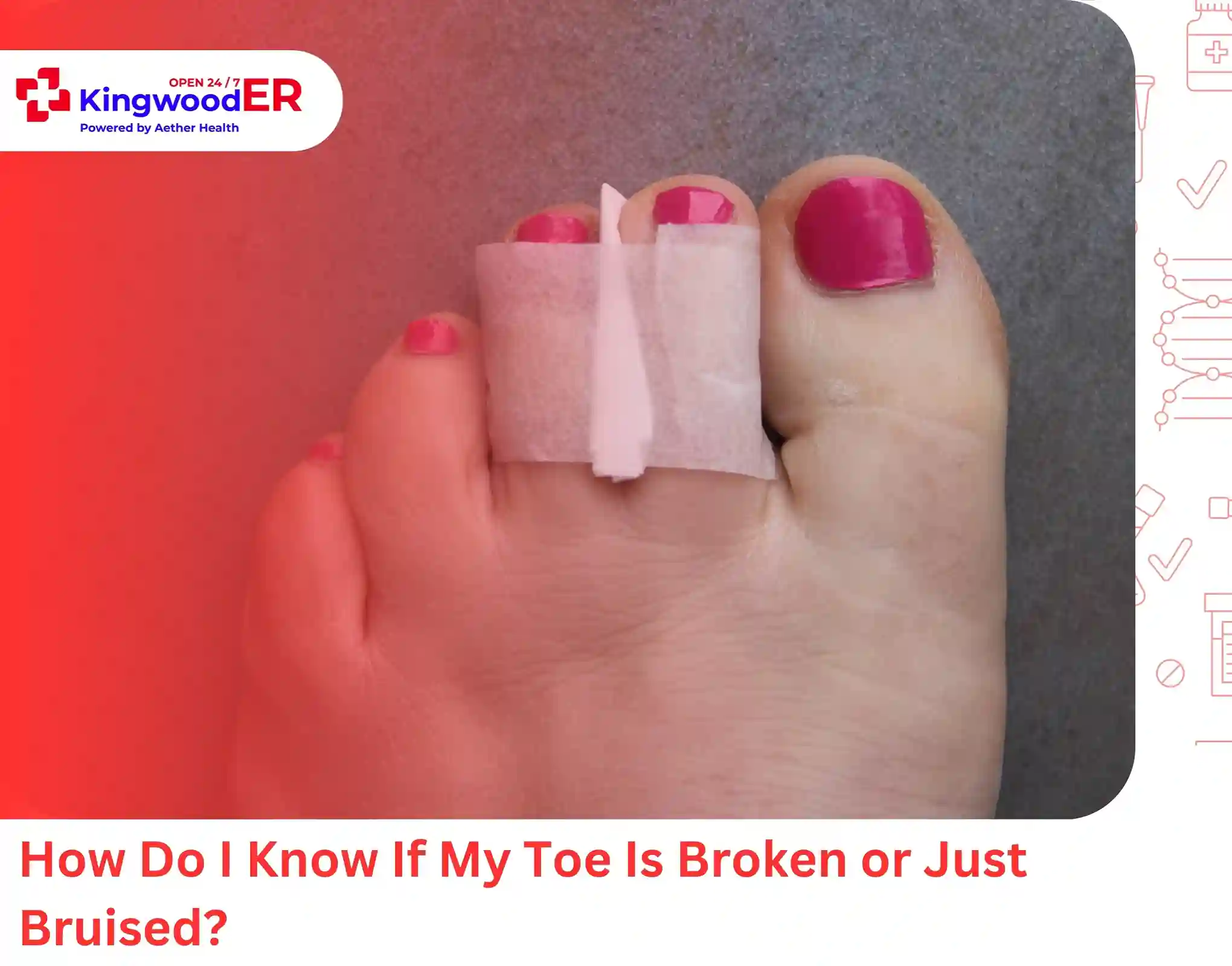 How Do I Know If My Toe Is Broken or Just Bruised