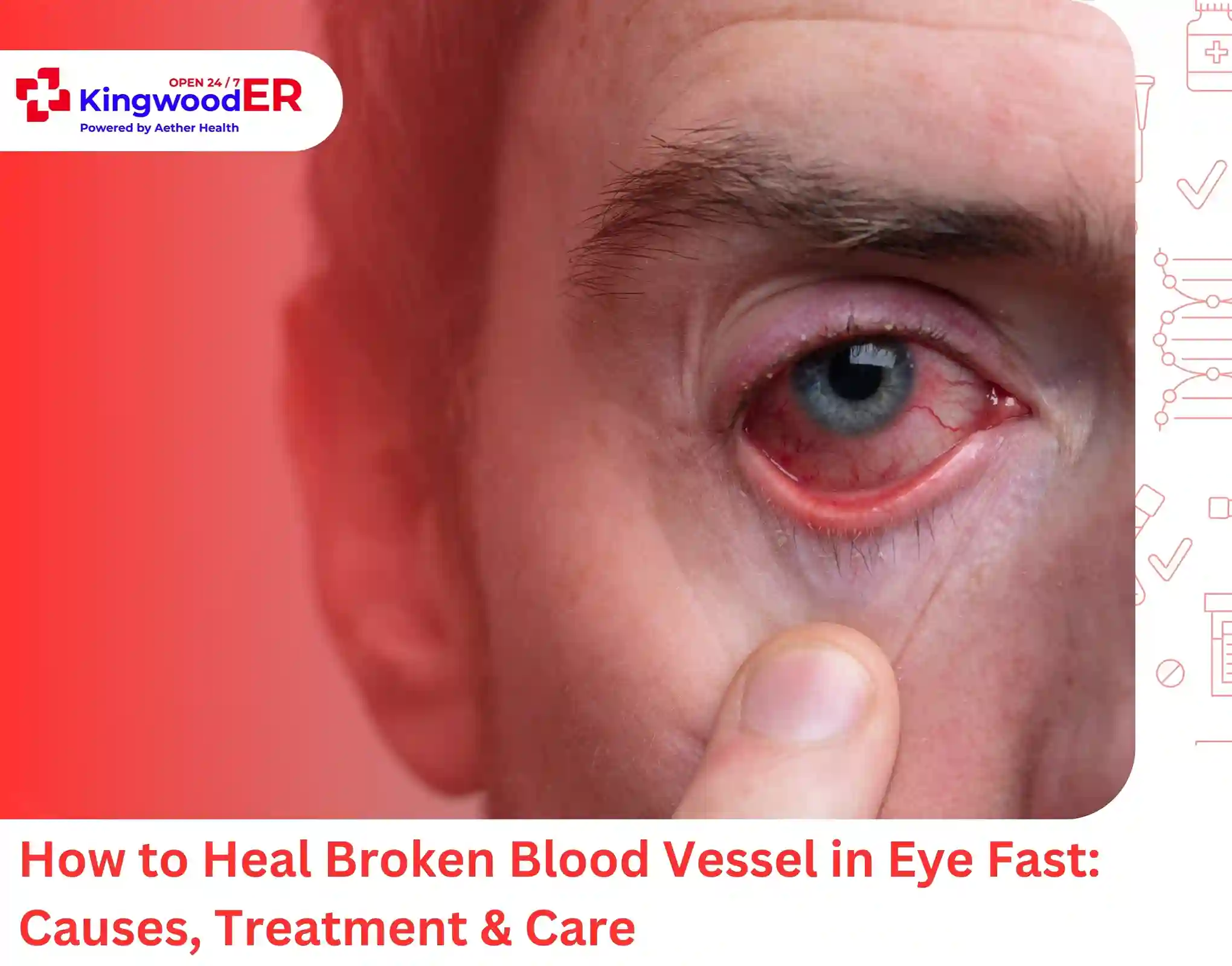 How to Heal Broken Blood Vessel in Eye Fast Causes, Treatment & Care