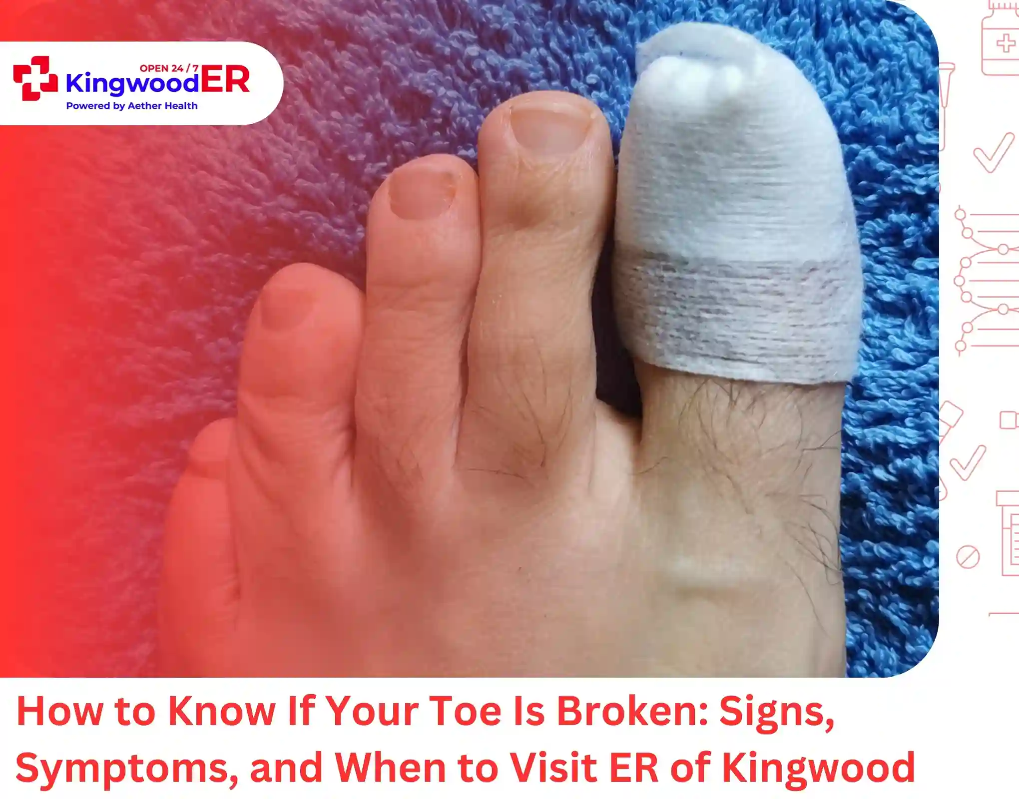 How to Know If Your Toe Is Broken