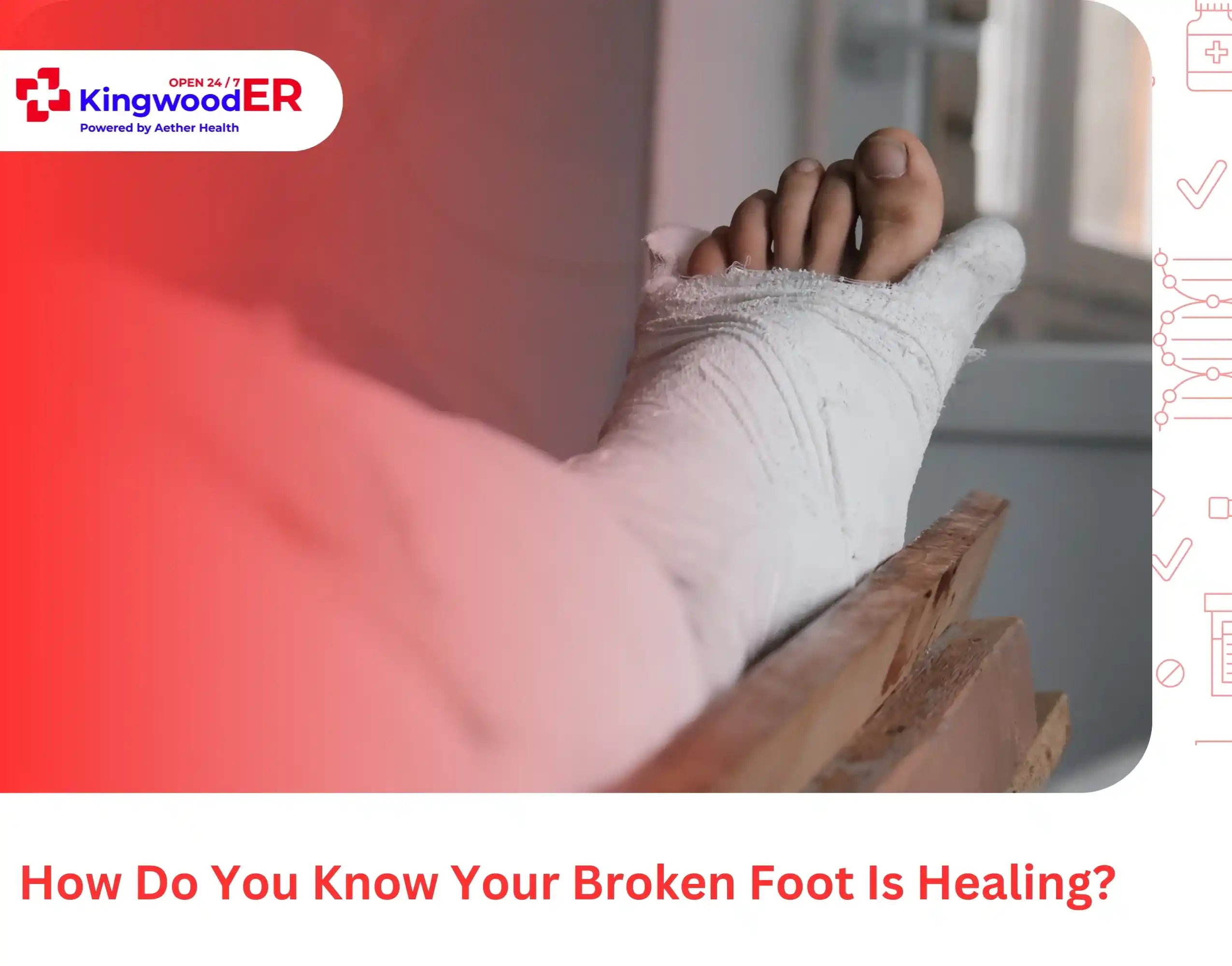 How Do You Know Your Broken Foot Is Healing