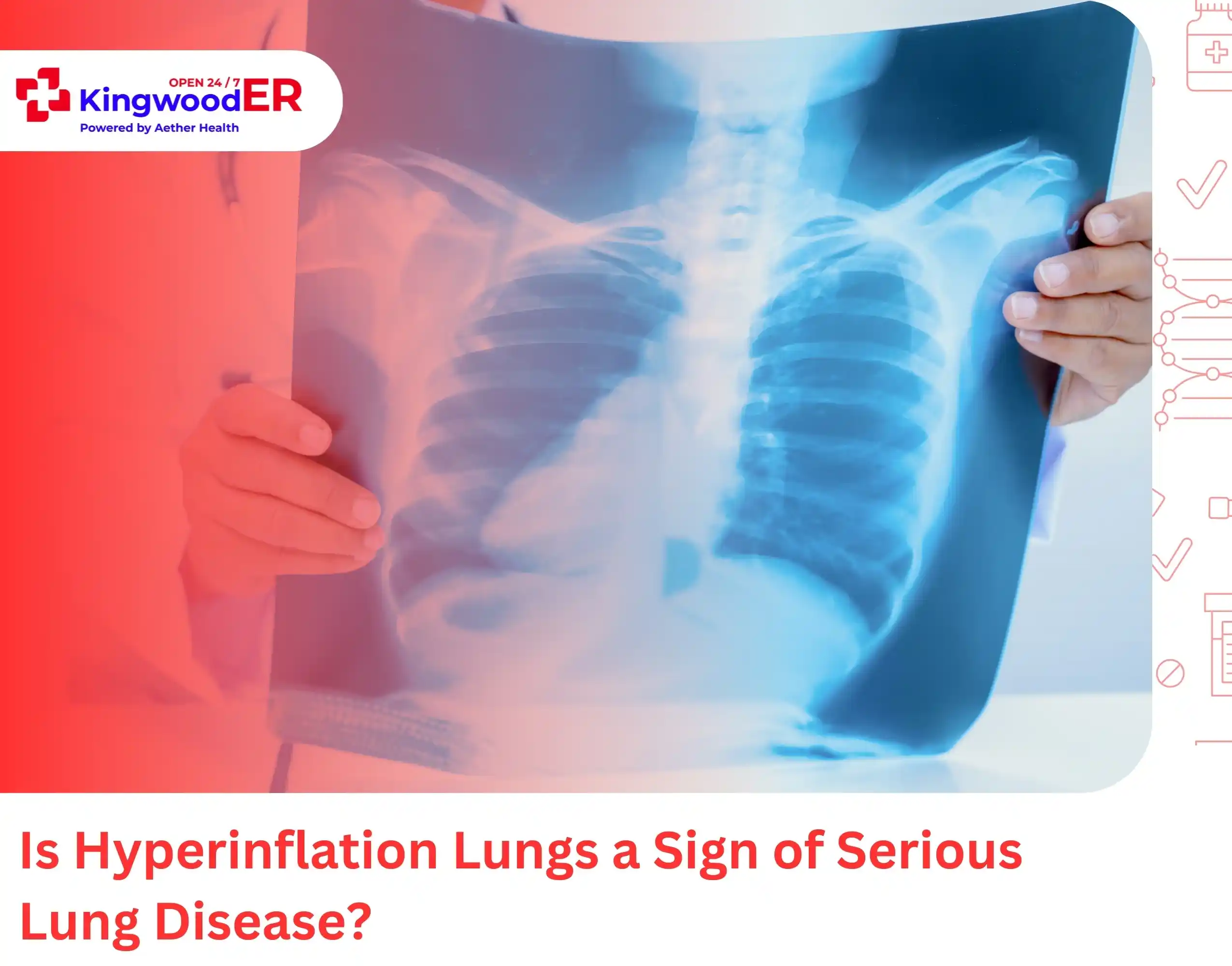 Is Hyperinflation Lungs a Sign of Serious Lung Disease