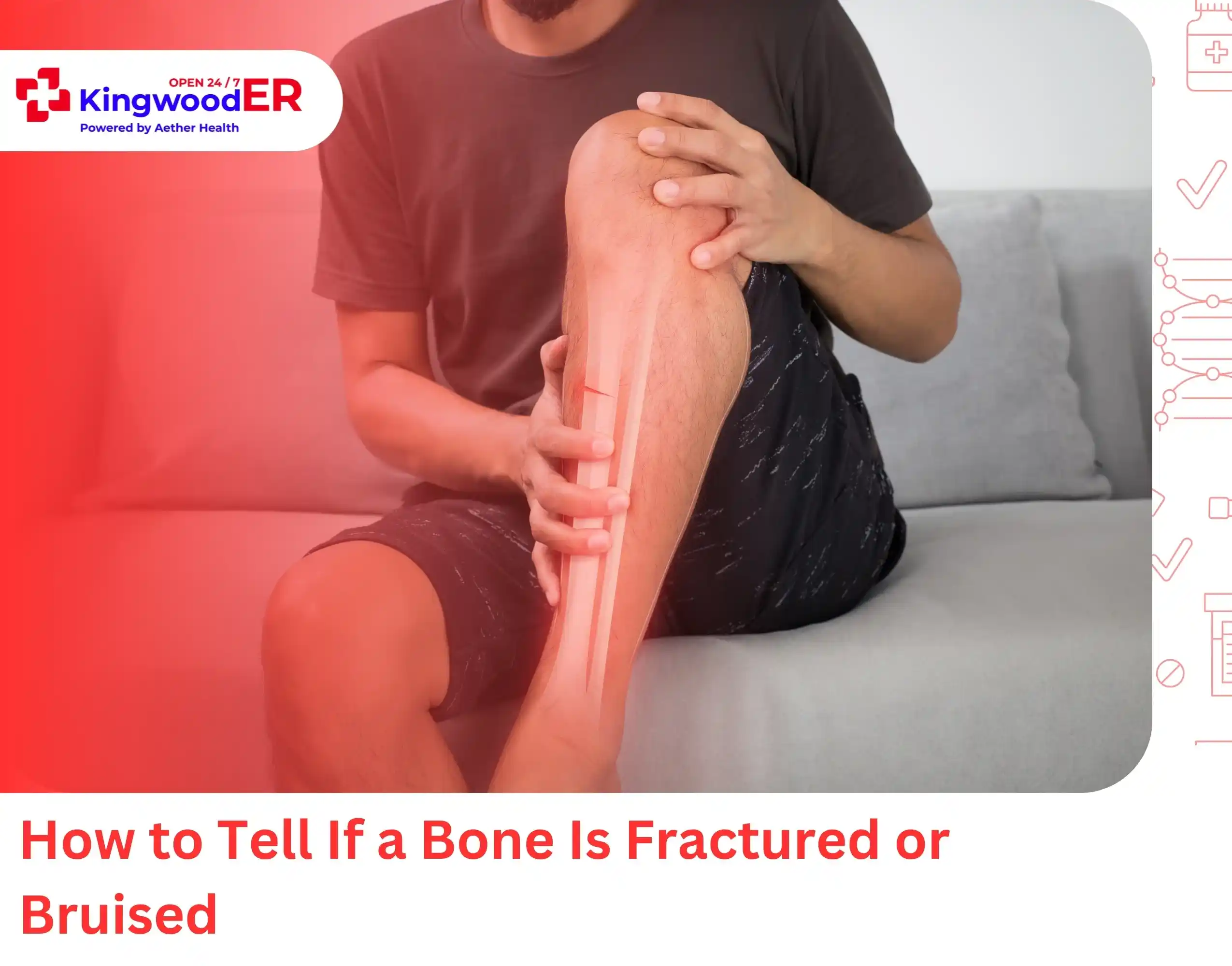 How to Tell If a Bone Is Fractured or Bruised