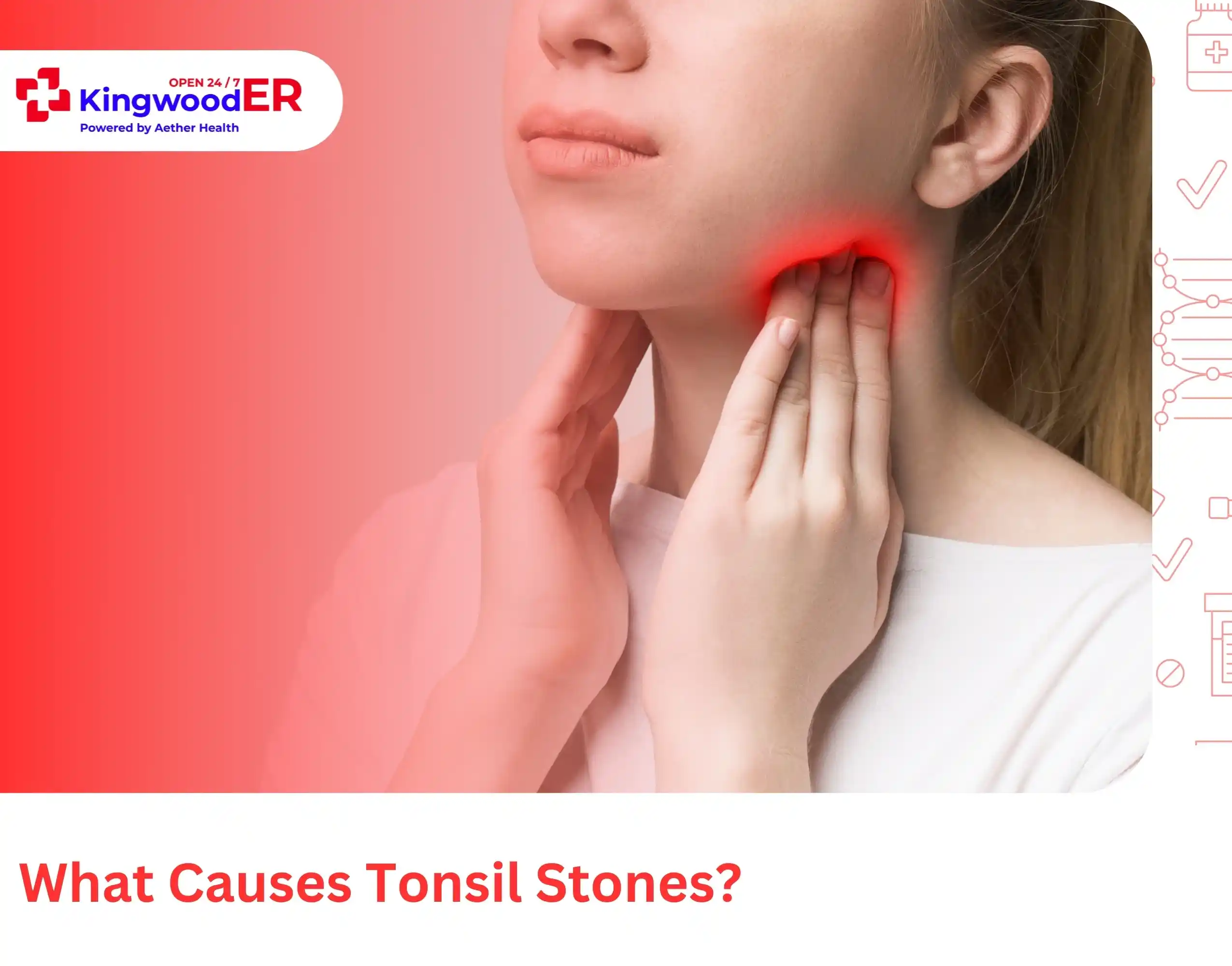 What Causes Tonsil Stones