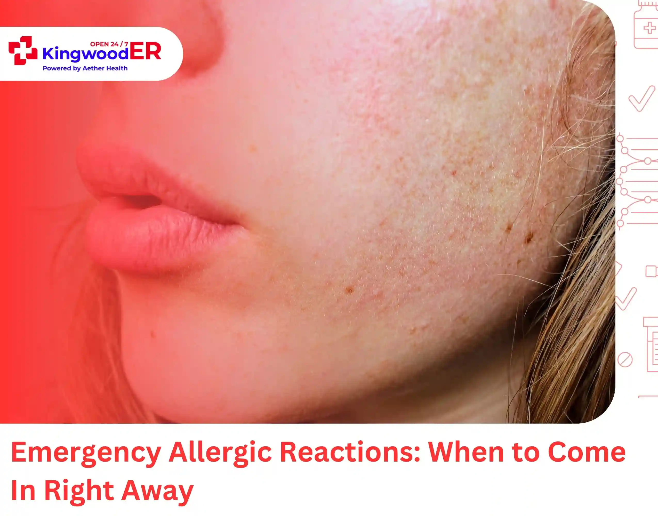 Emergency Allergic Reactions When to Come In Right Away