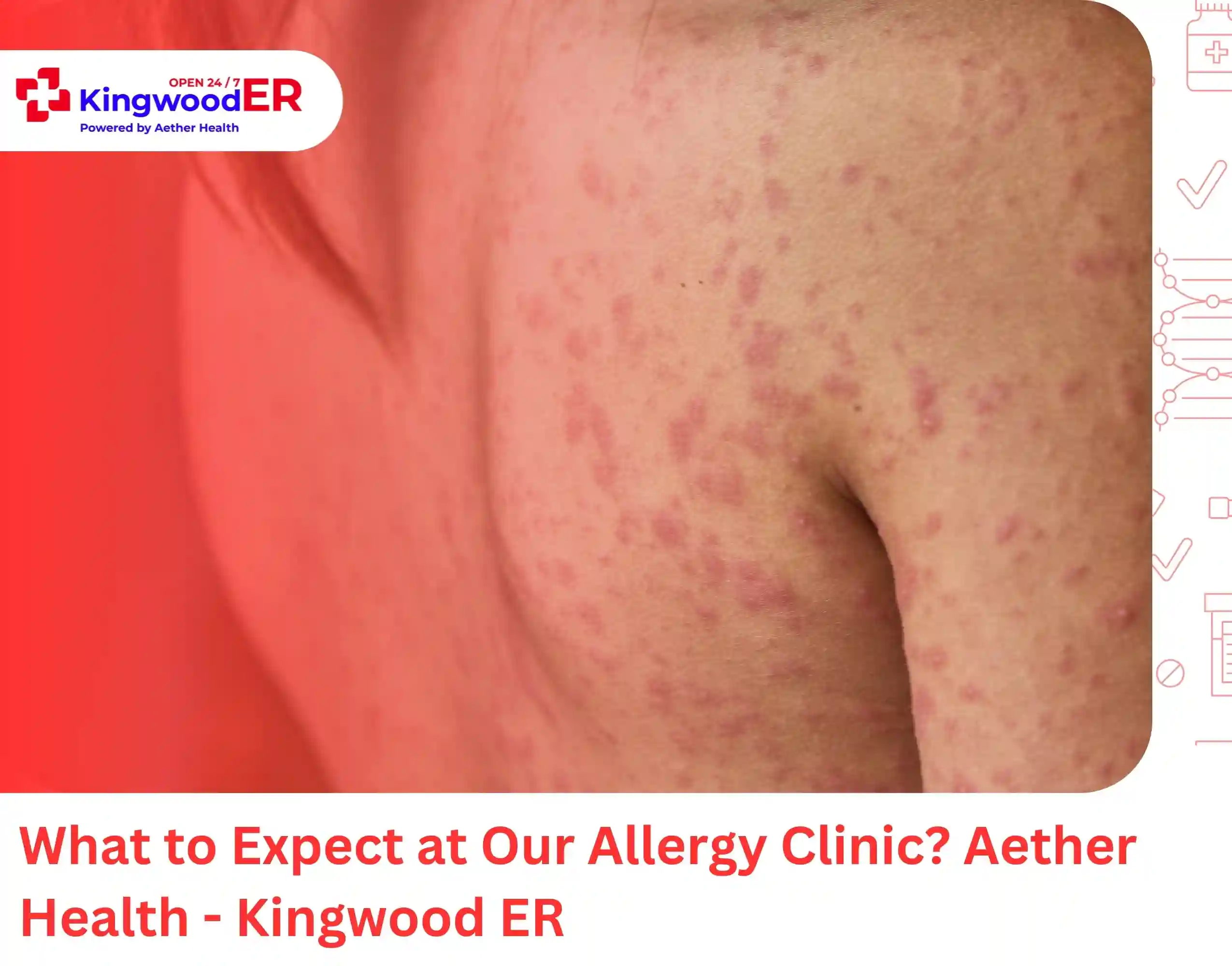 What to Expect at Our Allergy Clinic