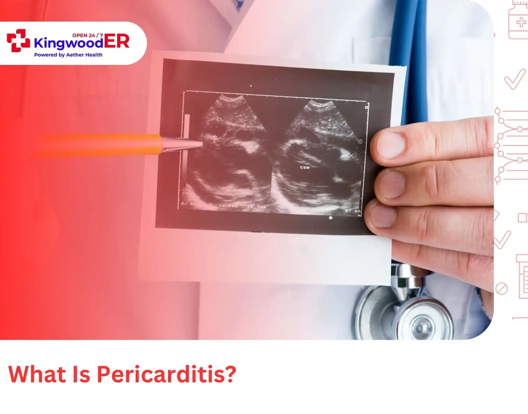 What Is Pericarditis