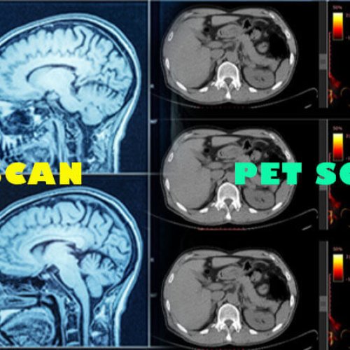 CT scan result and PET scan result